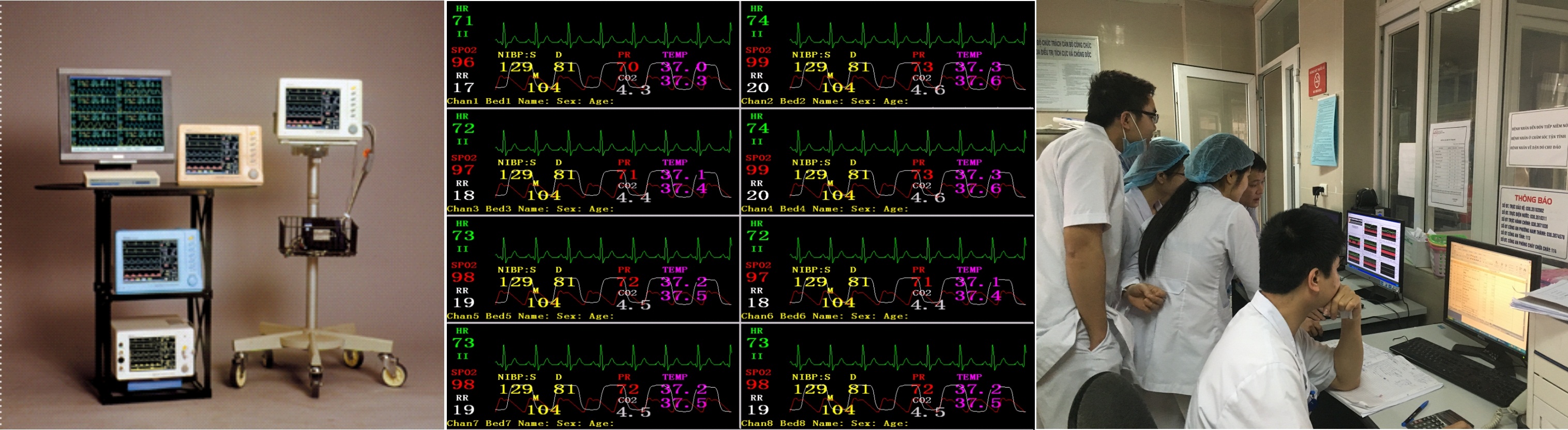 Multi-Parameter Patient Monitor System BK-CMS1.0